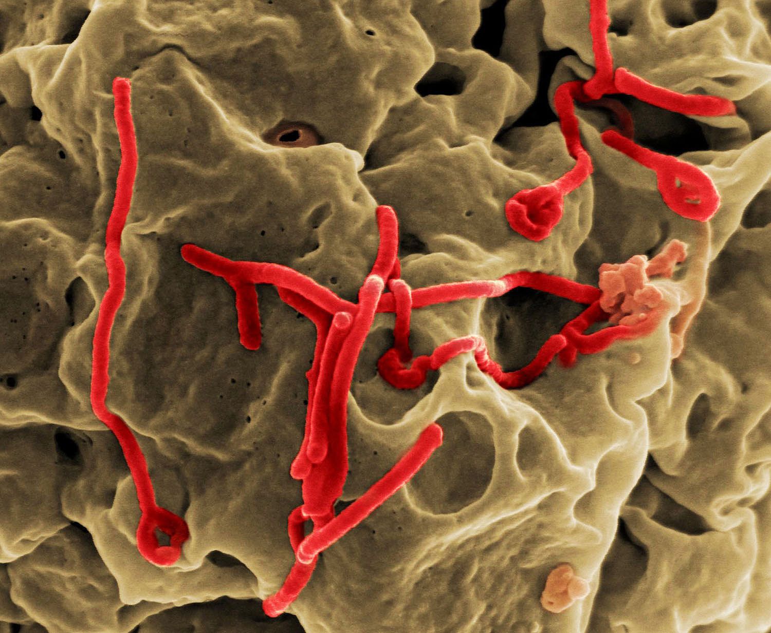 Micrograph of ebola virus