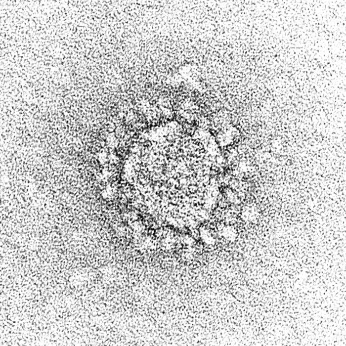 Electron microscope image of a virus shaped like a ball with protein protrusions around it.
