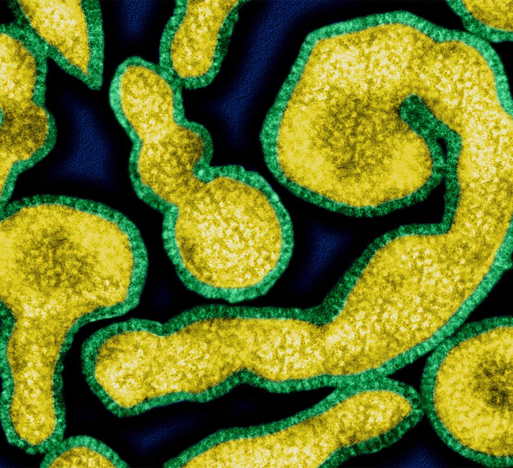 Influenza A virus, transmission electron micrograph